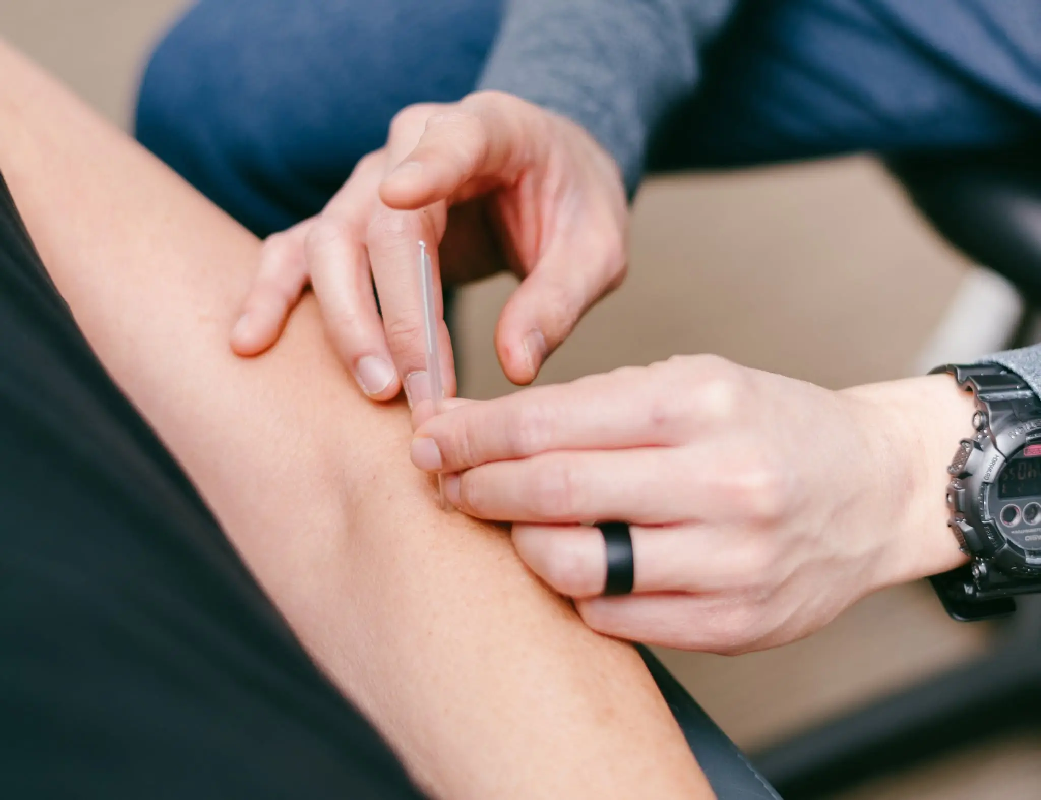 Acupuncture at Align